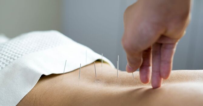 Cupping, Gua Sha, Ear acupressure